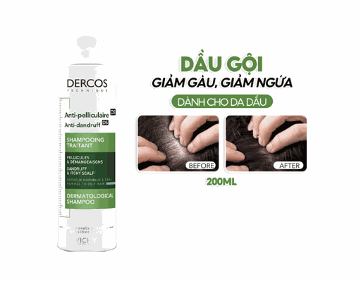 Dầu Gội Dercos Giảm Gàu Cho Da Đầu Dầu & Ngứa 200ml VICHY ảnh 1