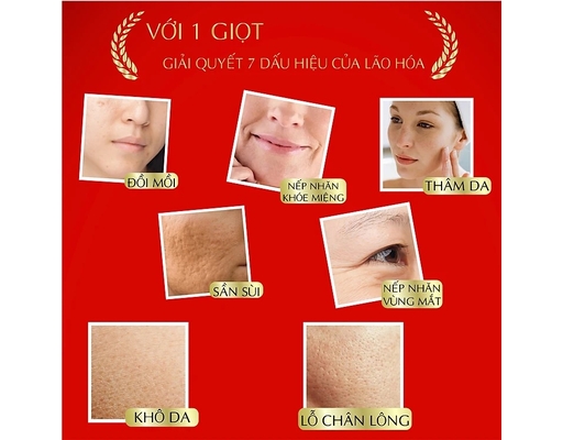 Tinh Chất Dưỡng Ẩm Chuyên Sâu Harinista Delivery Essence 30ml Meishoku ảnh 4