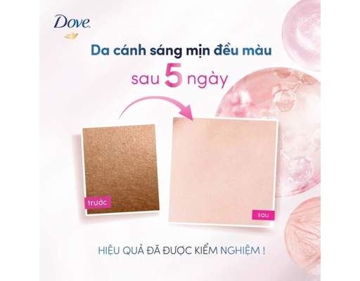 Serum Ngăn Mùi Giúp Mờ Thâm Thu Nhỏ Lỗ Chân Lông Deodorant Dry Serum 3% Niacinamide + 10X Vitamin C&E 40ml Dove ảnh 3