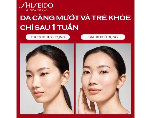 Nước Thần Đỏ Kích Hoạt Khả Năng Tự Thanh Lọc Và Phục Hồi Da Eudermine Activating Essence 145ml SHISEIDO ảnh 2