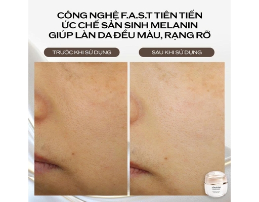 Gel Dưỡng Sáng Da Và Làm Mờ Đốm Nâu Thế Hệ Mới Benefiance Brightening Gel Cream 50ml SHISEIDO ảnh 4