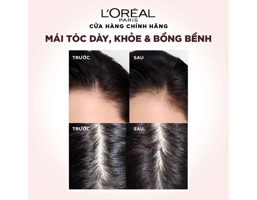 Dầu Xả Giúp Tóc Chắc Khỏe Và Ngăn Rụng Tóc 440ml L'Oreal ảnh 4