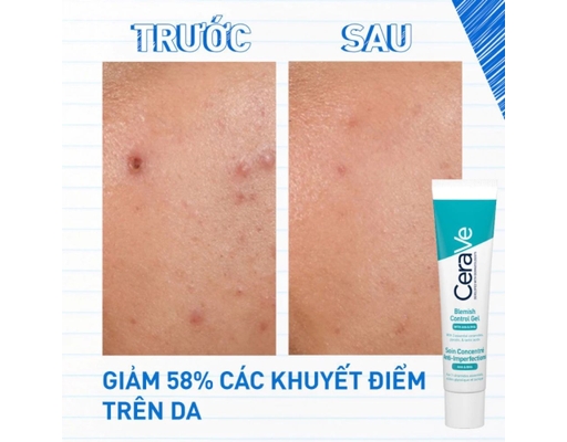 Gel Giảm Mụn Và Thâm Mụn Blemish Control Gel 40ml CeraVe ảnh 4