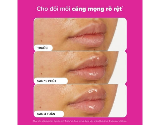 Son Dưỡng Môi Căng Mọng Và Mềm Mịn Pro-Collagen Peptide Gloss Balm 15ml Paula's Choice ảnh 5