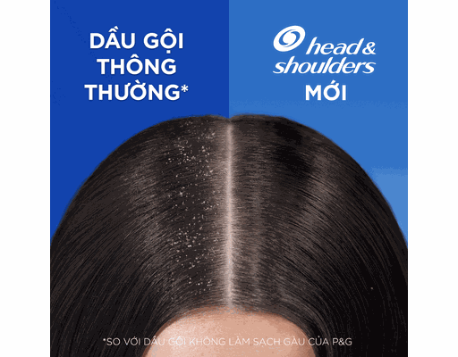 Dầu Gội Bạc Hà Mát Lạnh Cool Menthol Anti-Dandruff 850ml Head & Shoulders ảnh 5