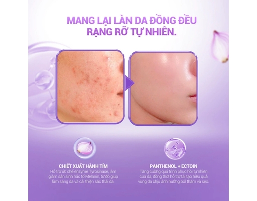 Mặt Nạ Hành Tím Dưỡng Ẩm Làm Dịu Mờ Sẹo & Thâm 30ml KEYSHU ảnh 4