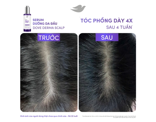 Serum Hỗ Trợ Giảm Rụng Tóc Derma Hairfall 45ml Dove ảnh 4