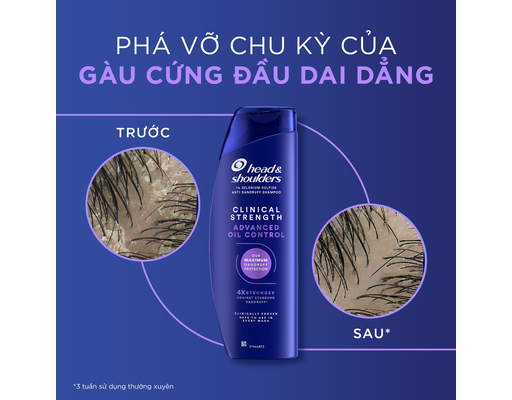 Dầu Gội Cho Tình Trạng Gàu Dai Dẳng Và Da Đầu Dầu 400ml Head & Shoulders ảnh 6