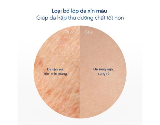 Tẩy Tế Bào Chết Dưỡng Ẩm Toàn Thân Hương Hoa Anh Đào 280g Dove ảnh 5
